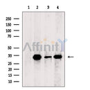 Western blot analysis of extracts from Mouse liver tissue?, using COQ4 Antibody. The lane on the left was treated with blocking peptide.