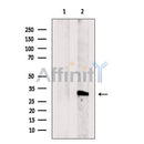 Western blot analysis of extracts from Mouse brain tissue, using COQ5 Antibody. The lane on the left was treated with blocking peptide.