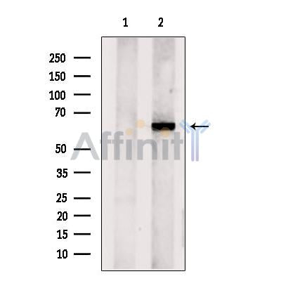 Western blot analysis of extracts from Mouse brain tissue, using CPNE6 Antibody. The lane on the left was treated with blocking peptide.