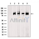 Western blot analysis of extracts from Jurkat cells, using CRACR2A Antibody. The lane on the left was treated with blocking peptide.