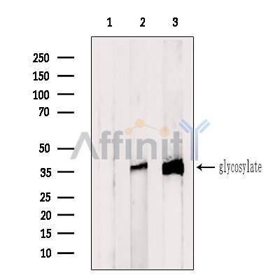 Western blot analysis of extracts from Jurkat cells, using CRISP3 Antibody. The lane on the left was treated with blocking peptide.
