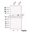 Western blot analysis of extracts from Mouse  brain, using CRMP4 Antibody. The lane on the left was treated with blocking peptide.