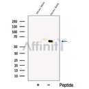 Western blot analysis of extracts from Hybridoma cells, using CRMP5 Antibody. The lane on the left was treated with blocking peptide.