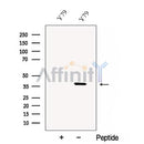 Western blot analysis of extracts from Y79 cells, using CRX Antibody. The lane on the left was treated with blocking peptide.