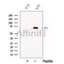 Western blot analysis of extracts from Huvec, using Cryptochrome 2 Antibody. The lane on the left was treated with blocking peptide.