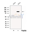 Western blot analysis of extracts from HeLa cells, using CSDE1 Antibody. The lane on the left was treated with blocking peptide.