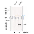 Western blot analysis of extracts from HepG2 cells, using CSRP2 Antibody. The lane on the left was treated with blocking peptide.