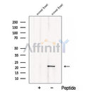 Western blot analysis of extracts from Mouse heart tissue, using CSRP3 Antibody. The lane on the left was treated with blocking peptide.