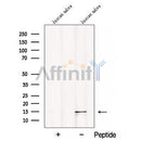 Western blot analysis of extracts from Hybridoma cells, using CST2-Specific Antibody. The lane on the left was treated with blocking peptide.