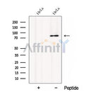 Western blot analysis of extracts from HeLa cells, using CTAGE1 Antibody. The lane on the left was treated with blocking peptide.