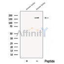 Western blot analysis of extracts from Mouse brain tissue, using CTTNBP2 Antibody. The lane on the left was treated with blocking peptide.