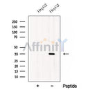 Western blot analysis of extracts from HepG2 cells, using CWC15 Antibody. The lane on the left was treated with blocking peptide.