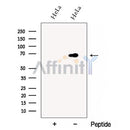 Western blot analysis of extracts from HeLa cells, using DCP1B Antibody. The lane on the left was treated with blocking peptide.