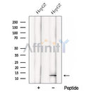 Western blot analysis of extracts from HepG2 cells, using DDA1 Antibody. The lane on the left was treated with blocking peptide.