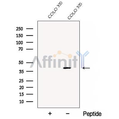 Western blot analysis of extracts from COLO 320 cells, using DDAH2 Antibody. The lane on the left was treated with blocking peptide.