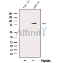 Western blot analysis of extracts from HEK-293 cells, using DDHD2 Antibody. The lane on the left was treated with blocking peptide.