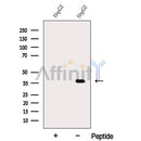 Western blot analysis of extracts from HepG2 cells, using DDRGK1 Antibody. The lane on the left was treated with blocking peptide.