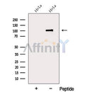 Western blot analysis of extracts from HeLa cells, using DDX10 Antibody. The lane on the left was treated with blocking peptide.