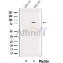 Western blot analysis of extracts from Hela, using DDX17 Antibody. The lane on the left was treated with blocking peptide.