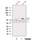 Western blot analysis of extracts from Huvec, using DDX6 Antibody. The lane on the left was treated with blocking peptide.