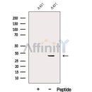 Western blot analysis of extracts from A431 cells, using DENR Antibody. The lane on the left was treated with blocking peptide.