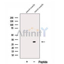 Western blot analysis of extracts from Mouse muscle tissue, using DKK2 Antibody. The lane on the left was treated with blocking peptide.