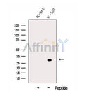 Western blot analysis of extracts from Rat  liver, using DLEU1 Antibody. The lane on the left was treated with blocking peptide.