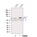 Western blot analysis of extracts from HeLa cells, using DNAJC11 Antibody. The lane on the left was treated with blocking peptide.