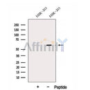 Western blot analysis of extracts from HEK-293 cells, using DNAJC7 Antibody. The lane on the left was treated with blocking peptide.