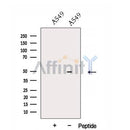Western blot analysis of extracts from Rat  liver, using DNASE2B Antibody. The lane on the left was treated with blocking peptide.