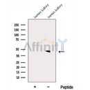 Western blot analysis of extracts from Human kidney tissue, using DPEP2 Antibody. The lane on the left was treated with blocking peptide.