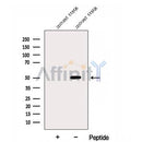 Western blot analysis of extracts from Huvec, using DYNC1LI2 Antibody. The lane on the left was treated with blocking peptide.