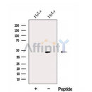 Western blot analysis of extracts from HeLa cells, using EAF1 Antibody. The lane on the left was treated with blocking peptide.