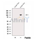 Western blot analysis of extracts from Mouse liver tissue?, using ECE2 Antibody. The lane on the left was treated with blocking peptide.