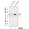 Western blot analysis of extracts from Rat  brain, using EHD2 Antibody. The lane on the left was treated with blocking peptide.