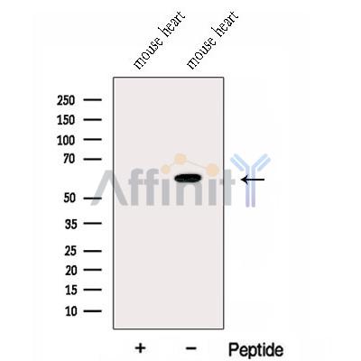 Western blot analysis of extracts from Rat  brain, using EHD2 Antibody. The lane on the left was treated with blocking peptide.