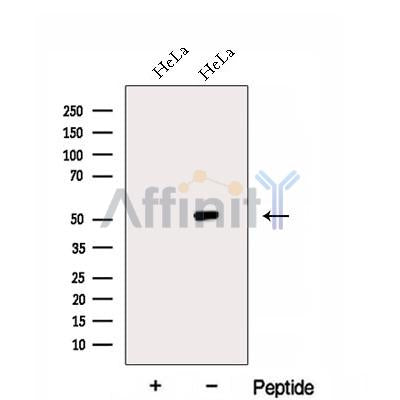 Western blot analysis of extracts from Hybridoma cells, using EIF2S3 Antibody. The lane on the left was treated with blocking peptide.