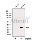 Western blot analysis of extracts from HeLa cells, using EIF4H Antibody. The lane on the left was treated with blocking peptide.