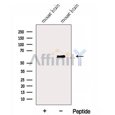 Western blot analysis of extracts from Mouse brain tissue?, using ENPP4 Antibody. The lane on the left was treated with blocking peptide.