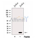 Western blot analysis of extracts from Jurkat cells, using ENY2 Antibody. The lane on the left was treated with blocking peptide.