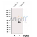 Western blot analysis of extracts from Hela, using ERLIN1 Antibody. The lane on the left was treated with blocking peptide.