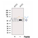 Western blot analysis of extracts from A431 cells, using ERO1L Antibody. The lane on the left was treated with blocking peptide.