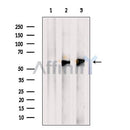 Western blot analysis of extracts from Human kidney tissue, using ESRRG Antibody. The lane on the left was treated with blocking peptide.