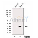 Western blot analysis of extracts from HepG2 cells, using EVI2A Antibody. The lane on the left was treated with blocking peptide.