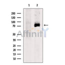 Western blot analysis of extracts from HEK-293 cells, using Exo70 Antibody. The lane on the left was treated with blocking peptide.