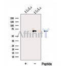 Western blot analysis of extracts from HeLa cells, using FAM13A Antibody. The lane on the left was treated with blocking peptide.