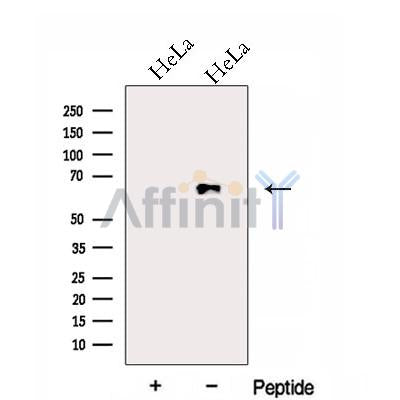 Western blot analysis of extracts from HeLa cells, using FAM13A Antibody. The lane on the left was treated with blocking peptide.