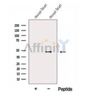 Western blot analysis of extracts from Mouse heart tissue, using FAM46C Antibody. The lane on the left was treated with blocking peptide.