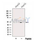 Western blot analysis of extracts from HepG2 cells, using FBXL14 Antibody. The lane on the left was treated with blocking peptide.