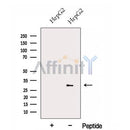 Western blot analysis of extracts from ?HepG2 cells, using FBXO17 Antibody. The lane on the left was treated with blocking peptide.